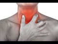 Mal di gola: sintomi, cause e rimedi 